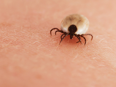 Ticks and Lyme Disease